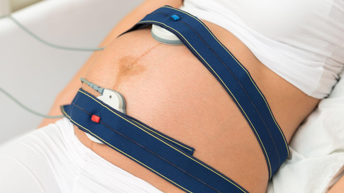 tracciato in gravidanza