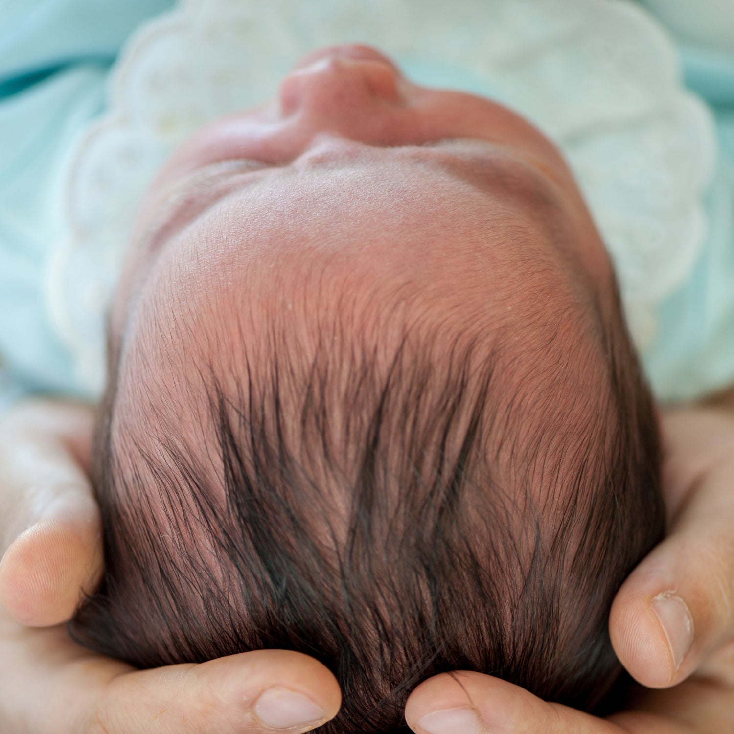 come curare e risolvere la plagiocefalia posizionale e la testa piatta del neonato