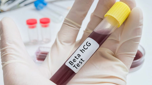 misurare la beta hcg