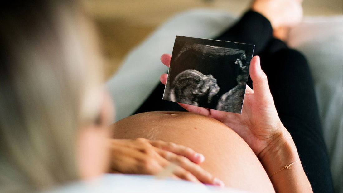 donna in gravidanza che ascolta i movimenti fetali tenendo in mano l'ecografia del suo bimbo