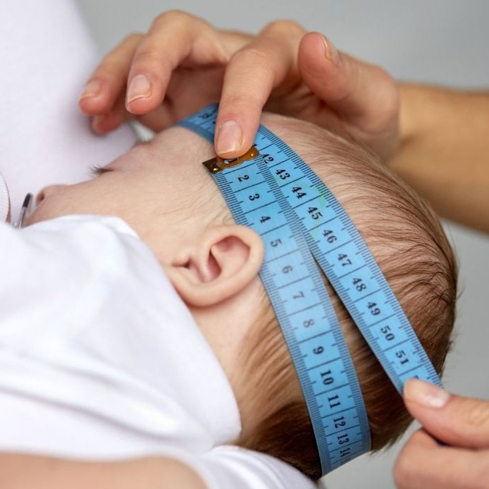 come curare e risolvere la plagiocefalia posizionale e la testa piatta del neonato